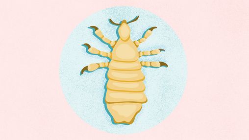 What Are Head Lice?