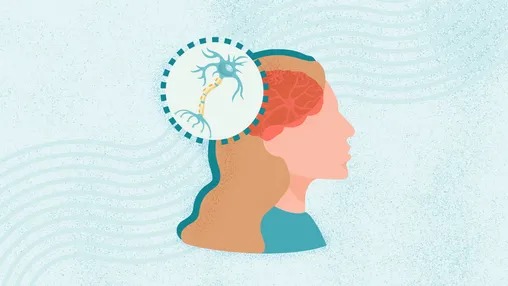 What Is Multiple Sclerosis?
